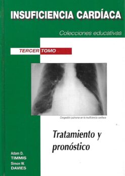 11253 247x346 - INSUFICIENCIA CARDIACA TRATAMIENTO Y PRONOSTICO