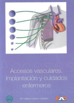 31177 247x346 - ACCESOS VASCULARES IMPLANTACION Y CUIDADOS ENFERMEROS