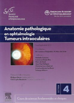 48251 247x346 - ANATOMIE PATHOLOGIQUE EN OPHTALMOLOGIE TUMEURS INTRAOCULAIRES