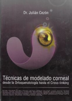 49996 247x346 - TECNICAS DE MODELADO CORNEAL DESDE LA ORTOQUERATOLOGIA HASTA EL CROSS LINKING